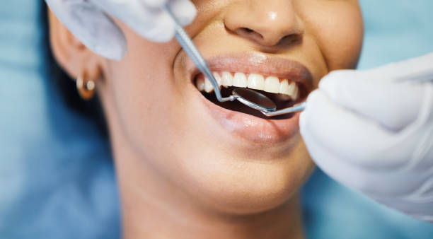 Best Emergency Dentist for Knocked-Out Tooth in Edmonston, MD